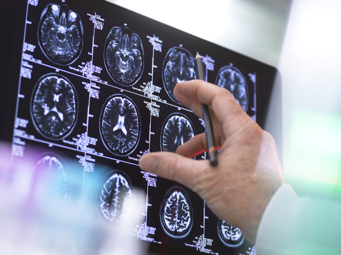 Europe&#8217;s brain health needs a serious coordination plan