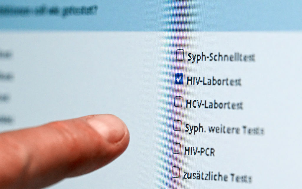 Half of Europeans with HIV diagnosed late, report shows  