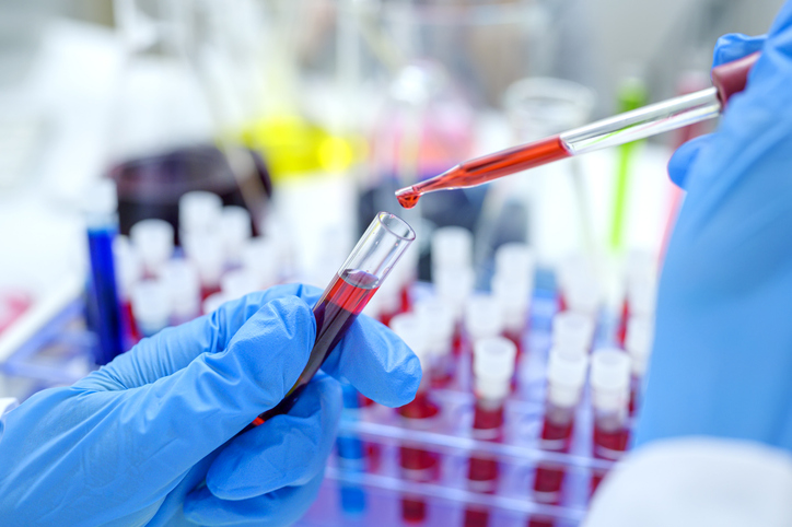 EU HIV diagnoses plateau as campaigners demand new action plan