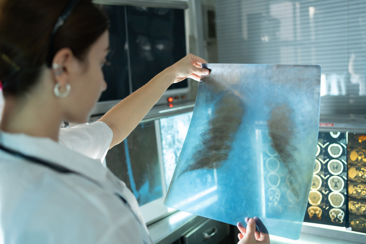 Europe has plans for cancer and heart disease – lung health is still waiting