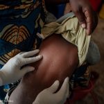WHO warns: Malaria response risks falling into 